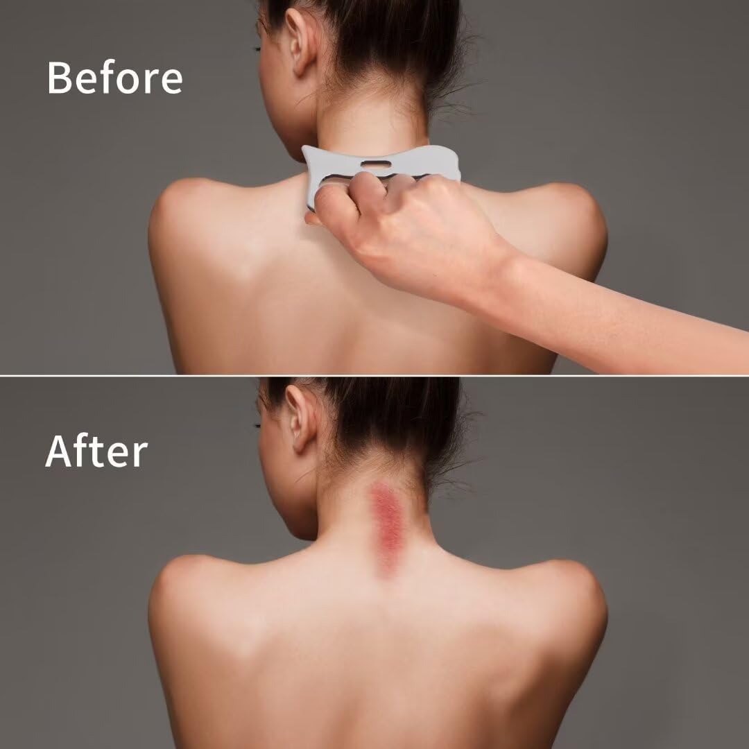 Cureava IASTM GRIP-Cm1